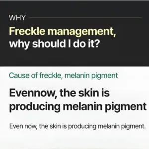 Why should I manage freckles