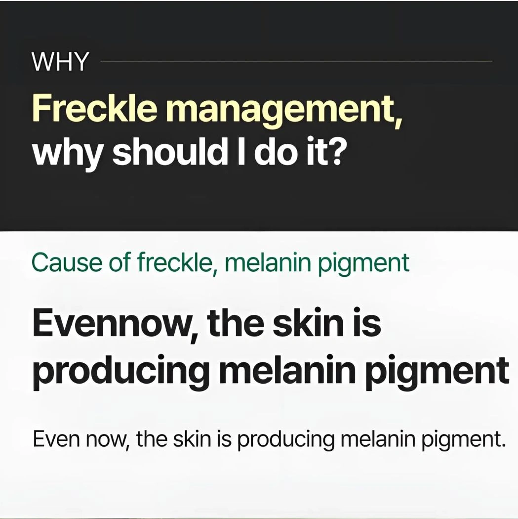 Why should I manage freckles Why should I manage freckles