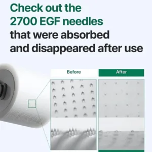 how 2700 EGF needles works