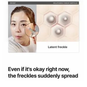 how freckles spread on skin