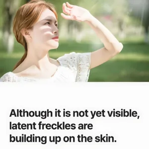 how sunlight build freckles on skin