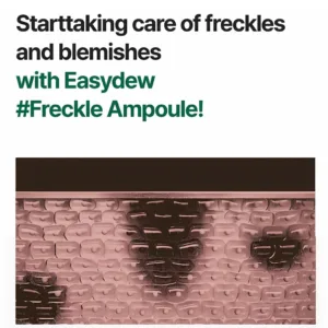 start taking care of freckles using derma tox needle shot