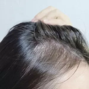 CICA peptide anti hair loss derma shampoo